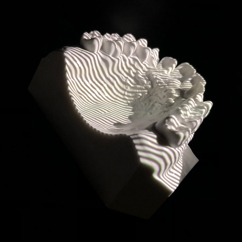 デジタルスキャン中の石膏模型